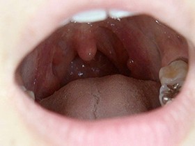 300人のおくち 第1集　サンプル画像05